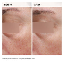 5% Face and Body Emulsion - Easy Lift
