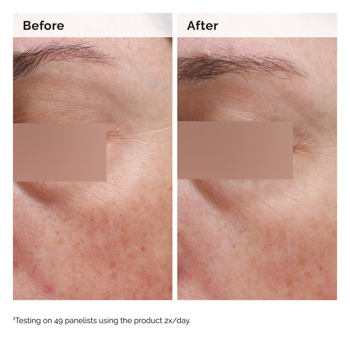 5% Face and Body Emulsion - Easy Lift