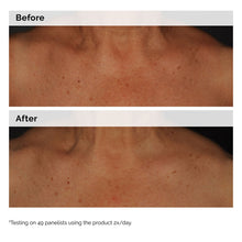 5% Face and Body Emulsion - Easy Lift