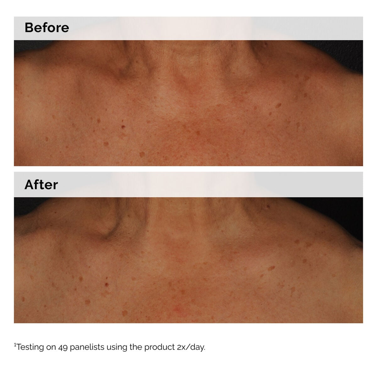 5% Face and Body Emulsion - Easy Lift
