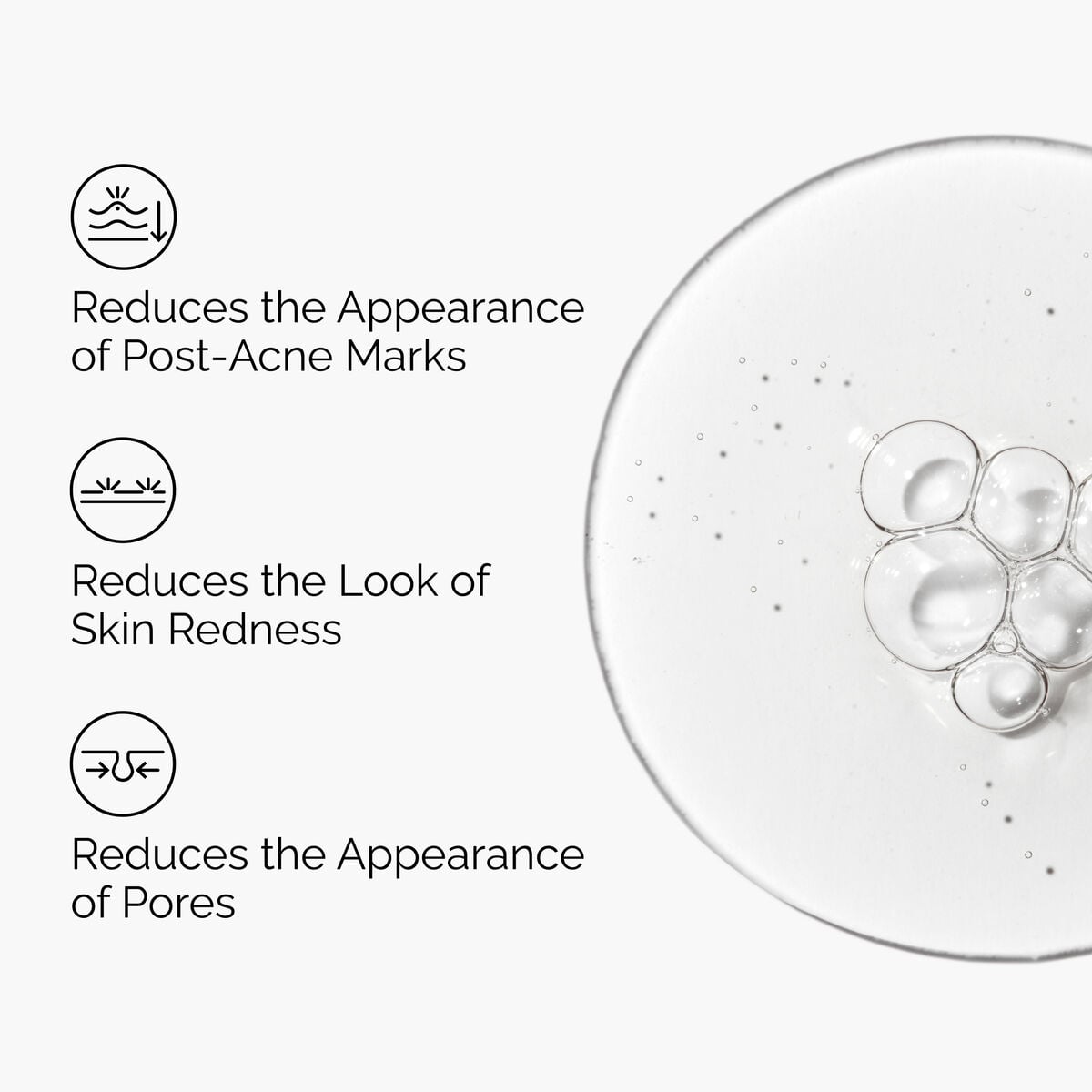 Aloe 2% + NAG 2% Solution - Fresh Reset