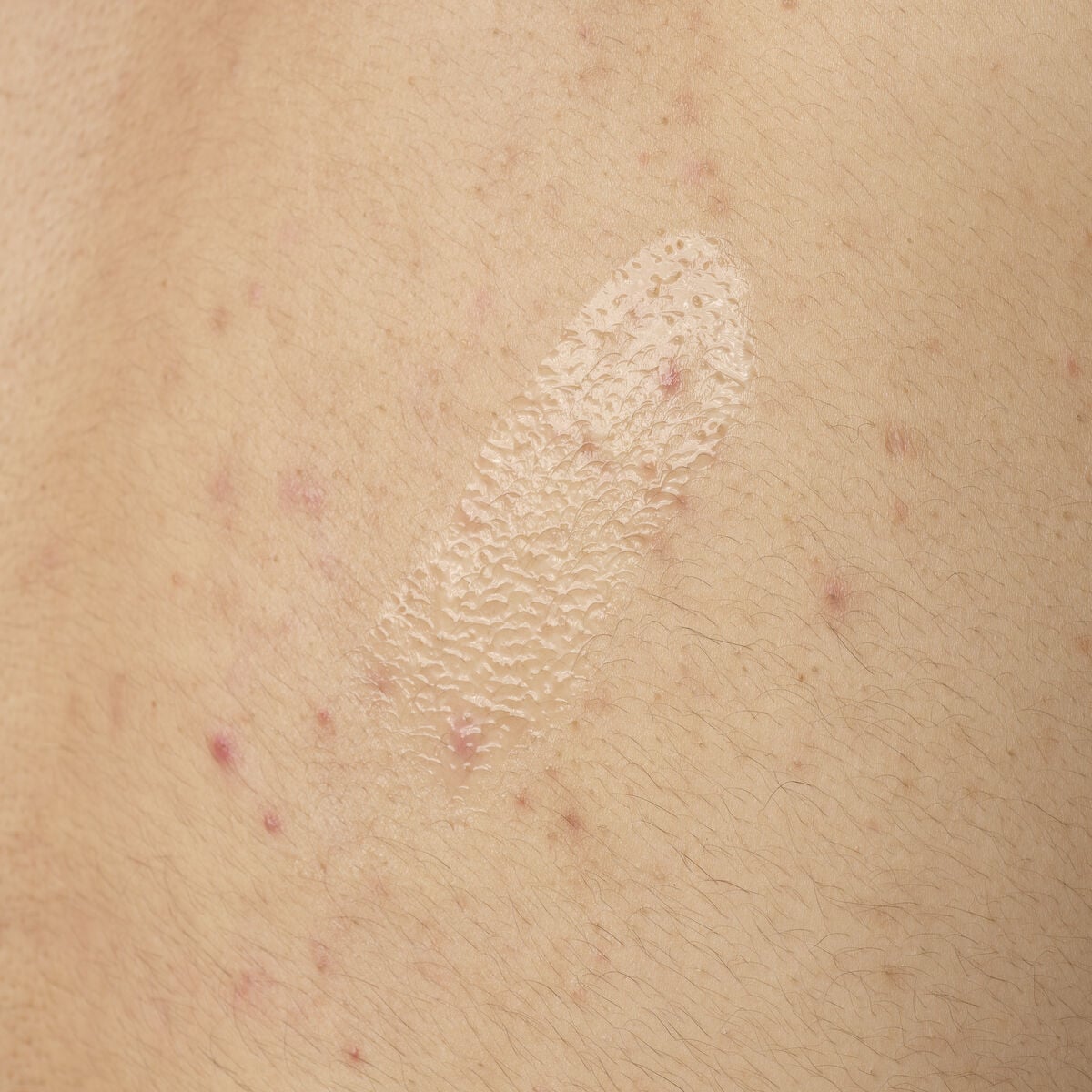 Acid 0.5% Body Serum - Fresh Tint