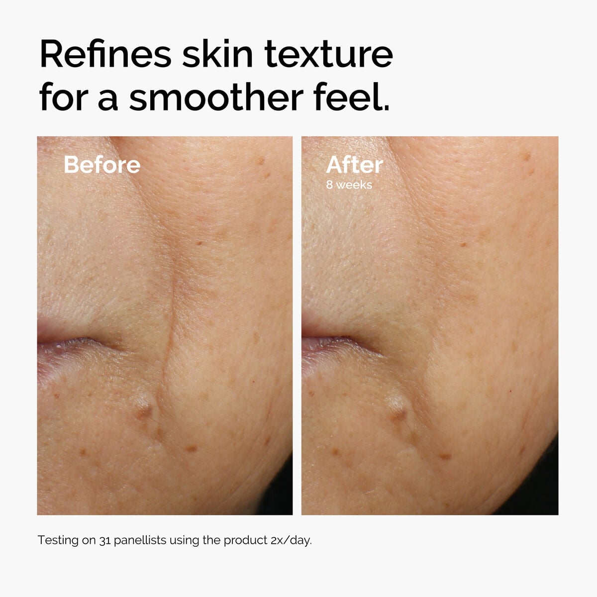 3% + Escin 1% Face Serum - Clear Balance