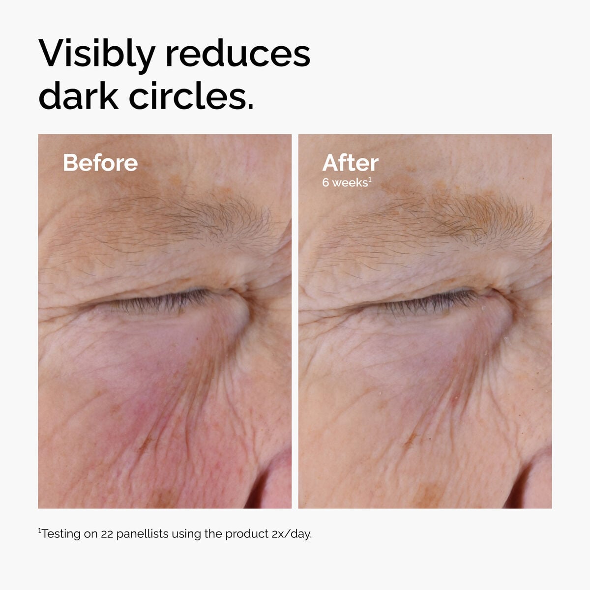 5% + EGCG Eye Serum - Home Choice