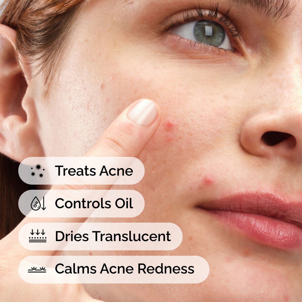 Sulfur 10% Powder-to-Cream Concentrate - Soft Balance